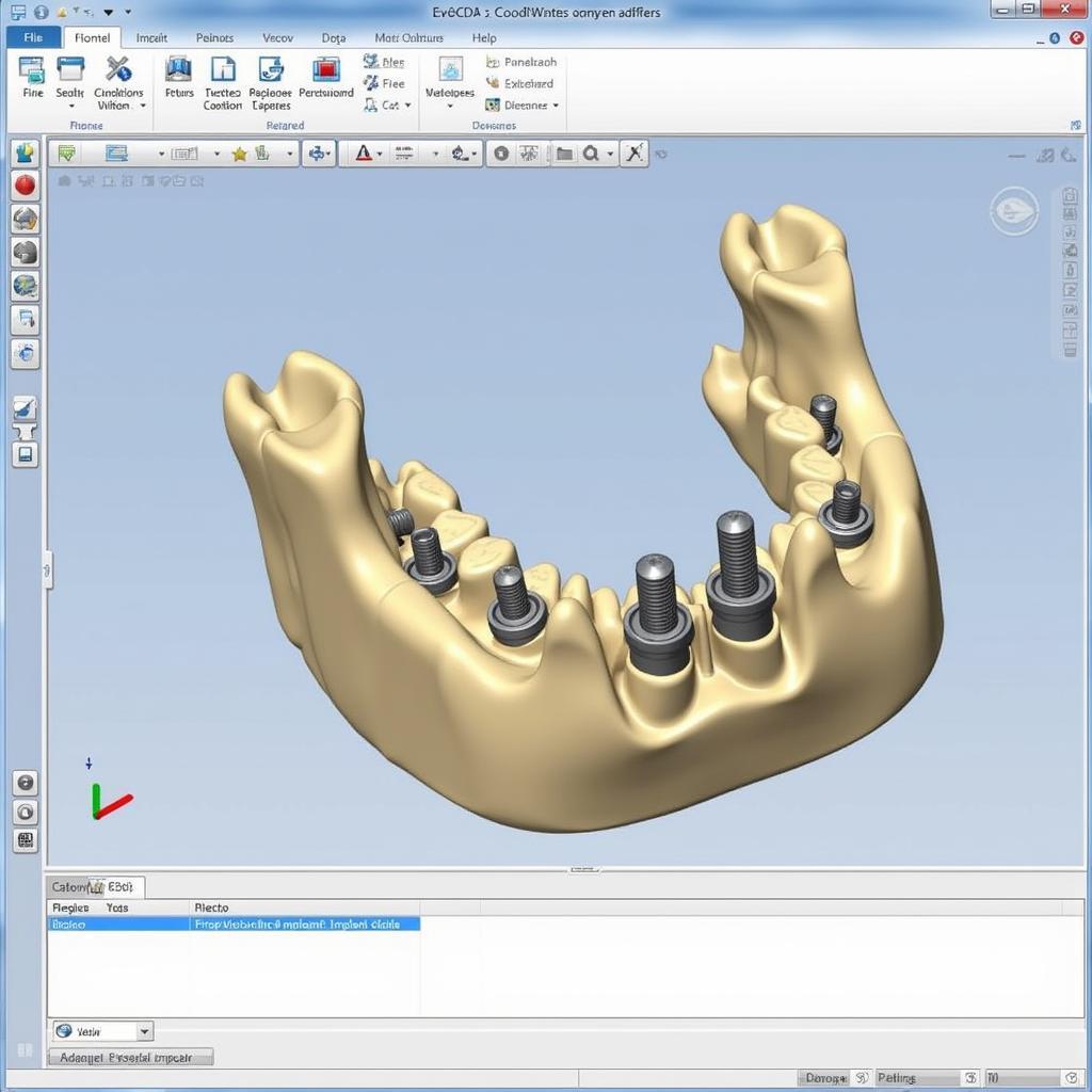 Digital implant planning using exocad software